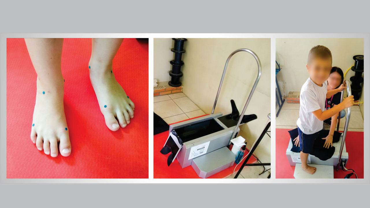 Biomecânica do IBTeC  avalia pés de crianças para  subsidiar indústrias de calçados na busca por um calce mais confortável